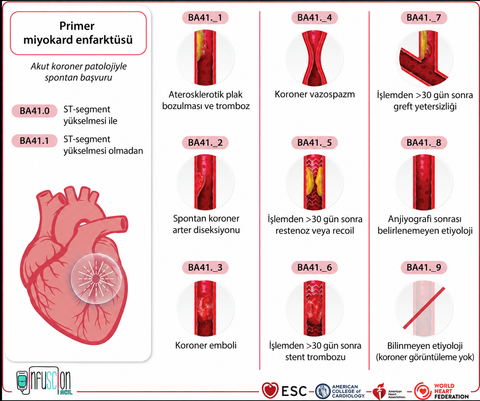 Şekil 3 Akut koroner patolojiye bağlı primer miyokard enfarktüsü