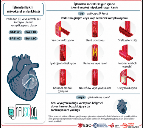 Şekil 7. Kardiyak cerrahi veya girişim komplikasyonuna bağlı işlemle ilişkili miyokard enfarktüsü. Görsel açıklaması için lütfen şekil açıklamasına ve çevresindeki metne bakınız.