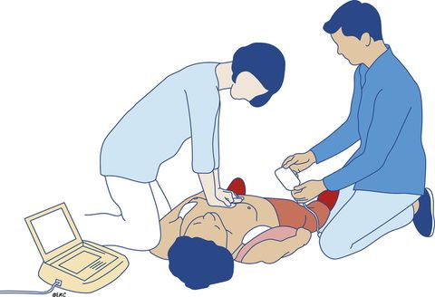 ERC: AED Geldiğinde Pedler Yerleştirilirken Kompresyonlara Devam Et