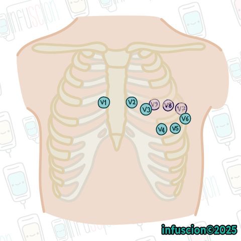 Posterior EKG Elektrot Yerleşimi