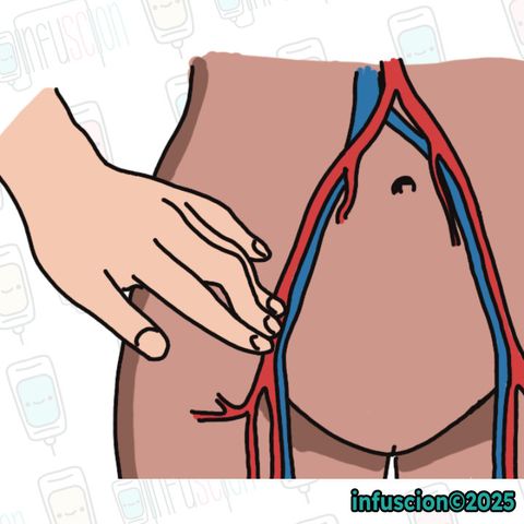 Femoral Nabız Palpasyonu
