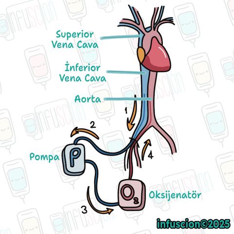 ECMO Çalışma Prensibi Şeması
